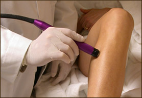 photo close up of women having laser hair removal